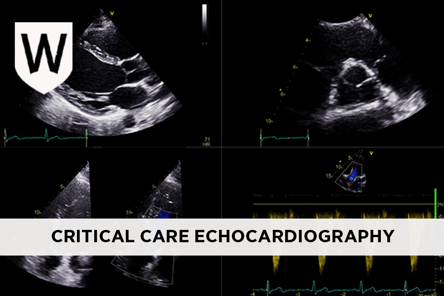 Critical Care Echocardiography